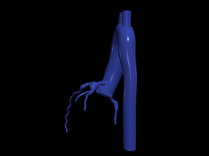 Coronary arteries and aorta Modèle 3D