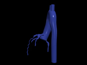 Coronary arteries and aorta 3D Model
