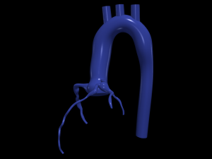 Coronary arteries and aorta Modèle 3D