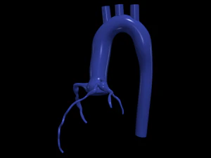 Coronary arteries and aorta 3D Model