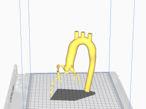 Coronary arteries and aorta Modèle 3D