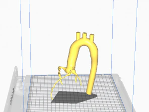 Coronary arteries and aorta 3D Model