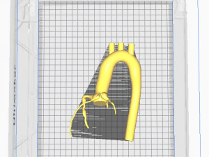 Coronary arteries and aorta 3D Model