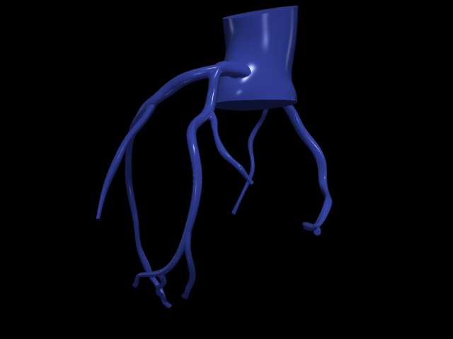 Coronary arteries Modelo 3D .c4d .max .obj .3ds .fbx .stl .blend 