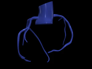 Coronary arteries 3D Model