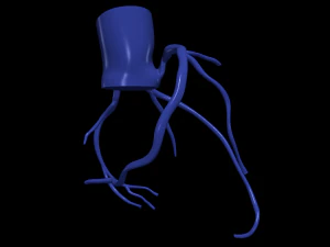 Coronary arteries 3D Model