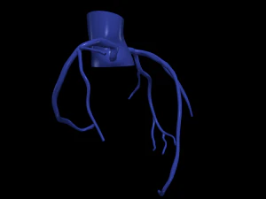 Coronary arteries 3D Model