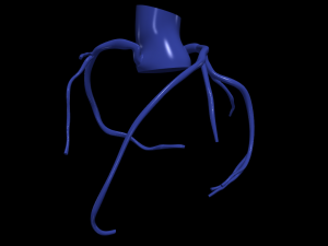 Coronary arteries Modelo 3D