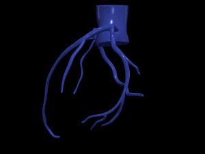 Coronary arteries 3D Model