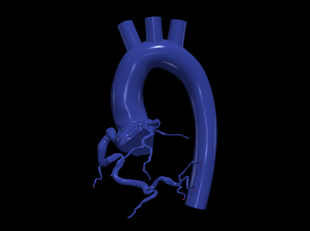 Coronary arteries and aorta 3D Model .c4d .max .obj .3ds .fbx .stl .blend