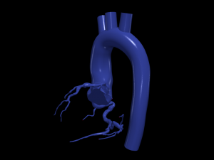 Coronary arteries and aorta Modèle 3D