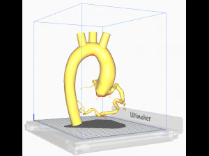 Coronary arteries and aorta 3D Model