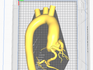 Coronary arteries and aorta Modèle 3D