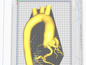 Coronary arteries and aorta 3D Model