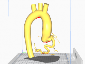 Coronary arteries and aorta Modèle 3D