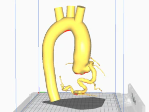 Coronary arteries and aorta 3D Model