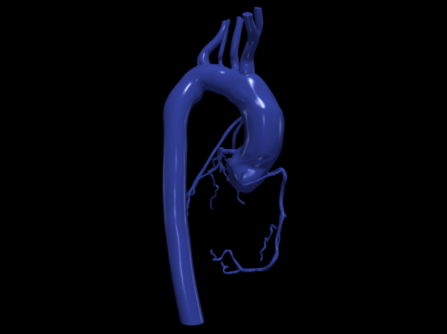 Coronary arteries and aorta Modelo 3D .c4d .max .obj .3ds .fbx .stl .blend 