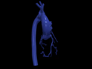 Coronary arteries and aorta 3D Model