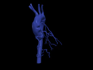 Coronary arteries and aorta 3D Model