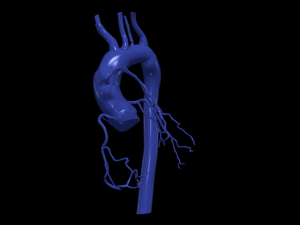 Coronary arteries and aorta Modelo 3D