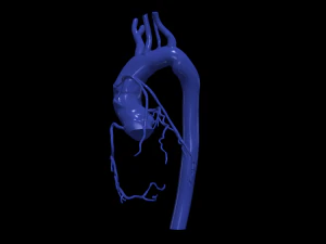 Coronary arteries and aorta 3D Model