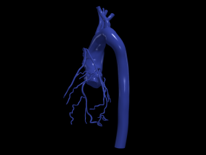 Coronary arteries and aorta Modelo 3D