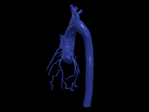 Coronary arteries and aorta 3D Model