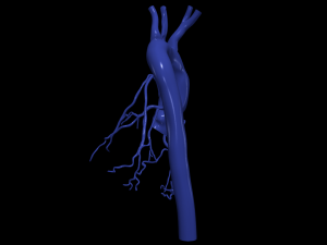 Coronary arteries and aorta Modelo 3D