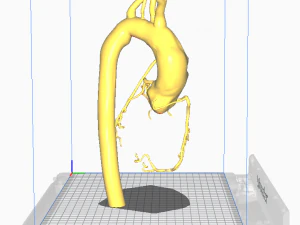 Coronary arteries and aorta 3D Model