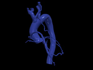 Coronary arteries and aorta 3D Model
