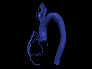 Coronary arteries and aorta 3D Model
