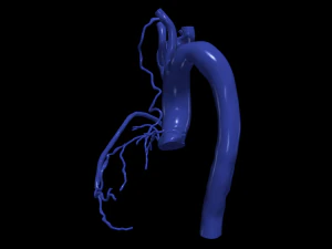 Coronary arteries and aorta 3D Model