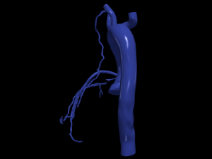 Coronary arteries and aorta 3D Модель