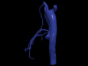 Coronary arteries and aorta 3D Model