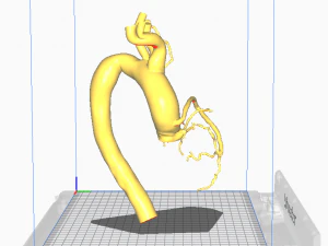 Coronary arteries and aorta 3D Model