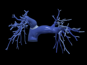 Pulmonary arteries 3D Model