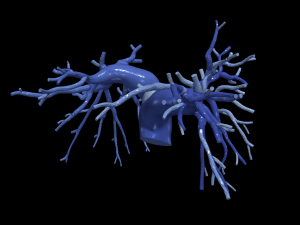 Pulmonary arteries 3D Model