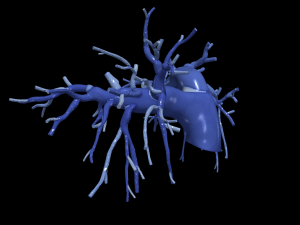 Pulmonary arteries 3D Model