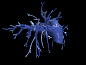 Lungenarterien 3D Modell