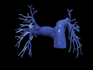 Lungenarterien 3D Modell