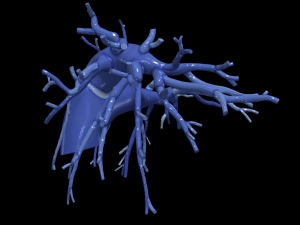 Pulmonary arteries 3D Model