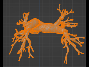 Pulmonary arteries 3D Model