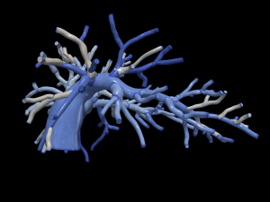 Pulmonary arteries Modèle 3D