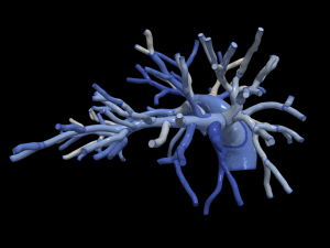 Pulmonary arteries Modèle 3D