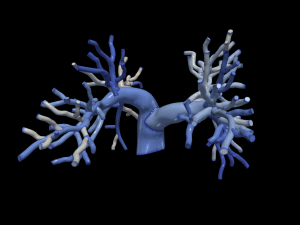 Pulmonary arteries Modèle 3D