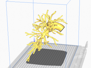 Pulmonary arteries Modèle 3D