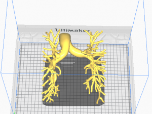 Pulmonary arteries Modèle 3D