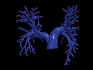 Pulmonary arteries 3D Model