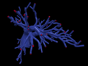 Pulmonary arteries 3D Model