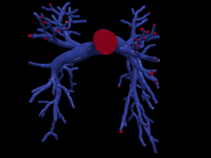Pulmonary arteries 3D Model